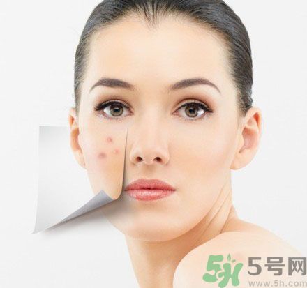 臉上有斑怎么去除？祛斑的小偏方有哪些？