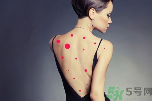 背上為什么會長痘痘？長痘痘怎么辦？