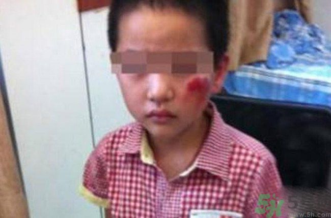 男孩遭校長(zhǎng)暴打的結(jié)果是什么？男孩遭校長(zhǎng)暴打的真相是什么？