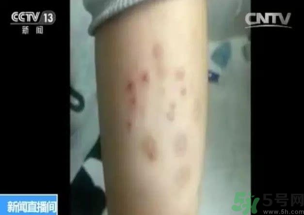 被污染學校是哪個？500師生患病的原因？