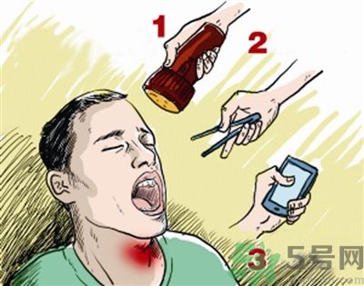 魚刺卡喉喝醋可以治療嗎？魚刺卡喉喝醋好不好？
