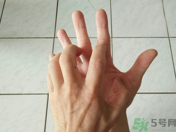 手上起水泡是什么原因？怎樣預(yù)防手上起水泡？