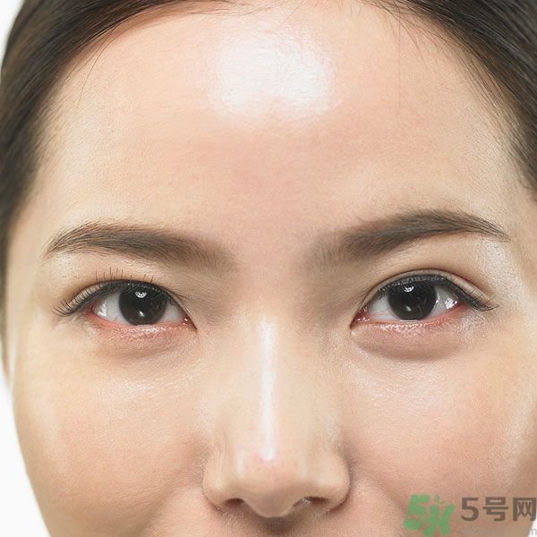 眉周紋是怎么形成的？眉周紋怎么去除？
