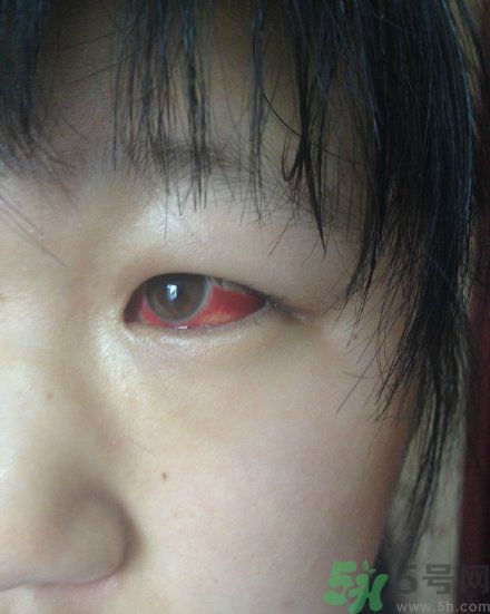 初中生全體甲醛中毒是怎么回事？初中生全體甲醛中毒是哪個學(xué)校？