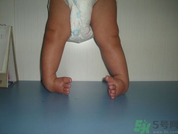 女生3天花8萬是怎么回事？馬蹄足是什么??？