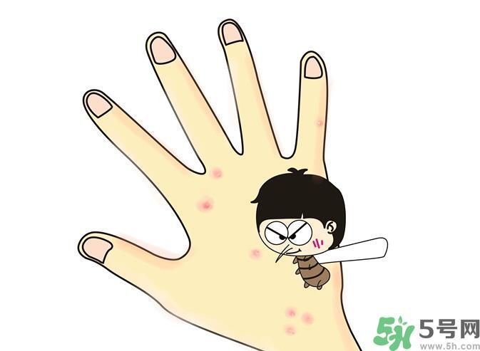 蚊子叮的包過幾天又癢是為什么？蚊子叮的包過幾天又癢怎么辦？