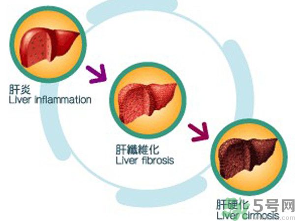 在外面吃飯會(huì)得乙肝嗎？在食堂吃飯會(huì)得乙肝嗎？