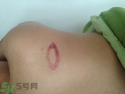 種草莓吻痕是什么意思？吻痕是怎么弄出來(lái)的？