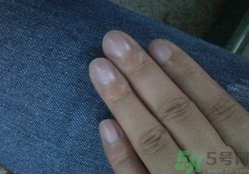 指甲發(fā)紫是什么原因？指甲發(fā)紫是怎么回事？