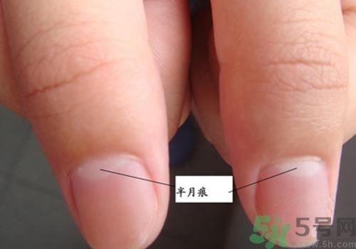 指甲沒有月牙是什么原因？指甲沒有月牙怎么調(diào)理？
