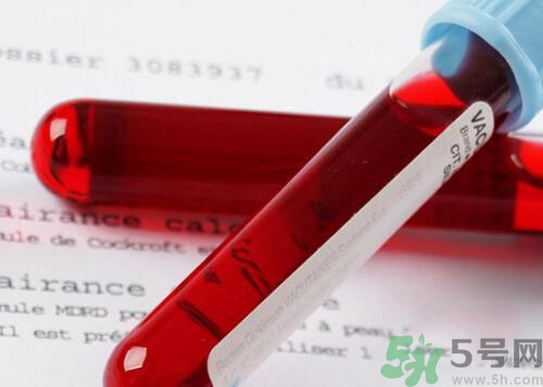 獻(xiàn)血后可以洗澡嗎？抽血后可以洗澡嗎？