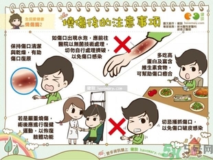 手被油燙傷了怎么處理？手被油燙起泡了怎么辦？
