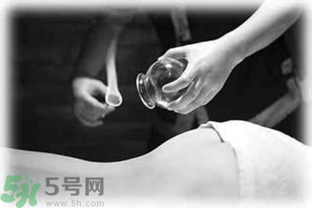 大暑可以拔罐嗎？大暑拔罐好不好？