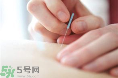 大暑可以針灸嗎？大暑針灸好不好？