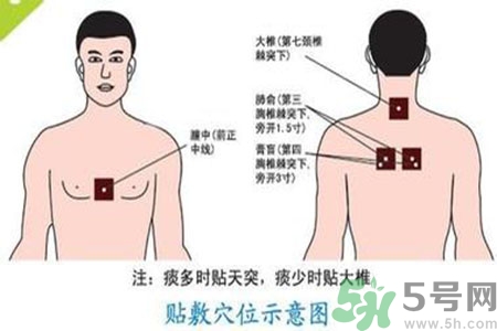 三伏貼能治頸椎病嗎？頸椎病三伏貼穴位