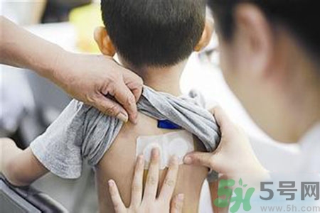 三伏貼能治頸椎病嗎？頸椎病三伏貼穴位