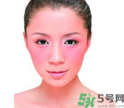 敏感性皮膚用什么洗面奶？敏感性皮膚怎么修復？