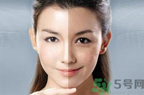 干性皮膚用什么洗面奶？干性皮膚該怎么保養(yǎng)？