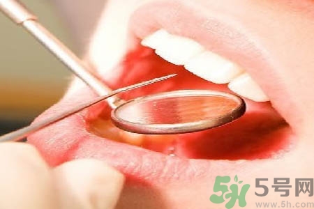 冷光美白牙齒是什么？冷光美白牙齒的好處有哪些？