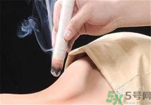 蕁麻疹可以艾灸嗎？蕁麻疹艾灸哪個(gè)穴位？