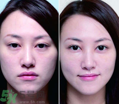 臥蠶是什么？臥蠶是眼袋嗎？