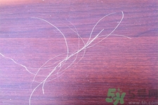 生完寶寶白頭發(fā)的原因？生完寶寶白頭發(fā)怎么辦？