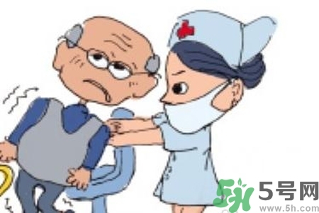 癲癇的典型癥狀有哪些？癲癇是什么？