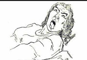癲癇的發(fā)病因素？癲癇的并發(fā)癥有哪些？