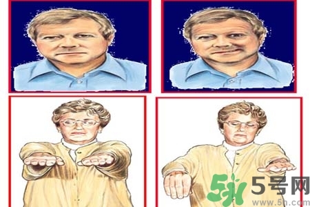 腦中風(fēng)是什么？腦中風(fēng)的癥狀？