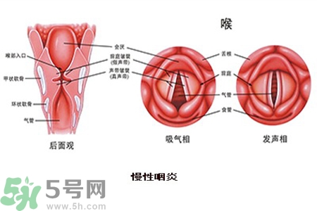 慢性咽炎是什么？慢性咽炎的癥狀有哪些？