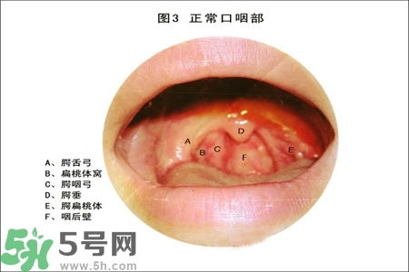慢性咽炎的治療方法？慢性咽炎的藥物治療？