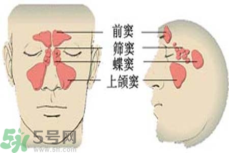 鼻竇炎是什么？鼻竇炎的癥狀有哪些？