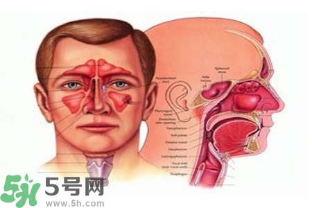 鼻竇炎的高發(fā)人群？如何預(yù)防鼻竇炎？