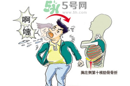 過敏性鼻炎是什么？過敏性鼻炎的癥狀有哪些？