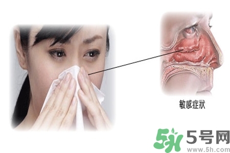 過(guò)敏性鼻炎的高發(fā)人群有哪些？如何預(yù)防過(guò)敏性鼻炎？