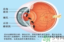 青光眼是什么？青光眼癥狀有什么？