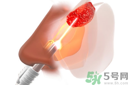 鼻咽癌的日常措施是什么？鼻咽癌注意的飲食有哪些？