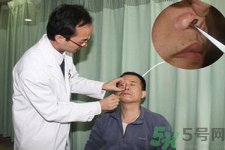 鼻咽癌的治療方法是什么？鼻咽癌可以用什么藥物治療？