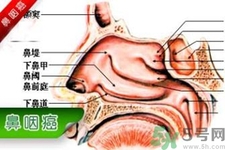 鼻咽癌的發(fā)病因素是什么？鼻咽癌的并發(fā)癥有哪些？