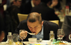 男人禿頂會遺傳嗎？男人禿頂是腎虛嗎？