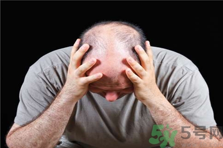脫發(fā)的治療方法是什么？脫發(fā)的藥物治療有哪些？