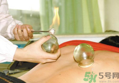 拔火罐和拔氣罐哪個(gè)好？拔火罐和拔氣罐的區(qū)別