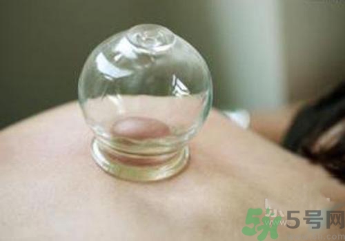拔火罐和拔氣罐哪個(gè)好？拔火罐和拔氣罐的區(qū)別