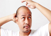 脫發(fā)的高發(fā)人群有哪些？如何預防脫發(fā)？