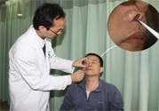 鼻咽癌的發(fā)病因素是什么？鼻咽癌的并發(fā)癥有哪些？