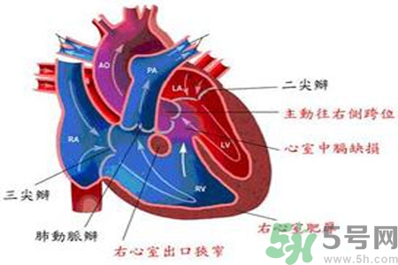 先天性心臟病需要注意什么？