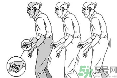 帕金森要注意哪些措施？帕金森的飲食需注意什么？