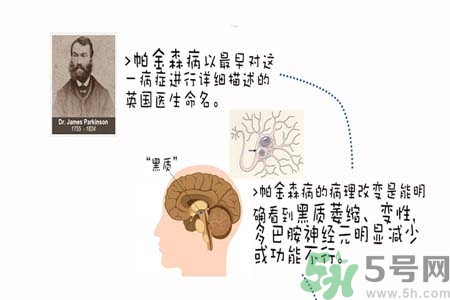 帕金森的治療方法有哪些？