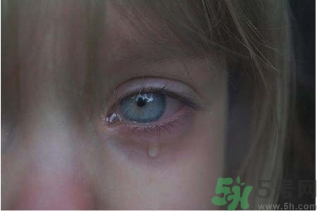 睡覺時(shí)流眼淚是怎么回事？如何保護(hù)眼睛？