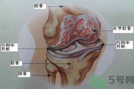 預(yù)防骨病需要注意哪些姿勢？秋季預(yù)防骨病的方法有哪些？